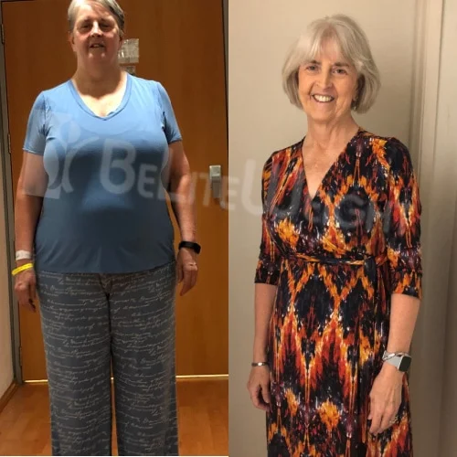Phyllis W - 2 Year Update*